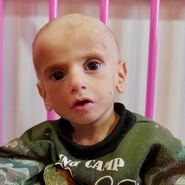 Ett av alla undernärda barn som nu får hjälp på ett sjukhus i norra Syrien efter terrorgruppen IS fall