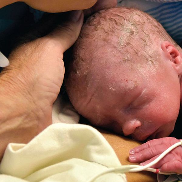 Mirakelbebisen – första att födas ur en transplanterad livmoder.