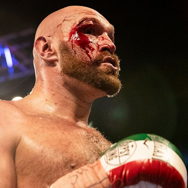 Blodet rinner ner för Tyson Furys ansikte under matchen mot Otto Wallin.
