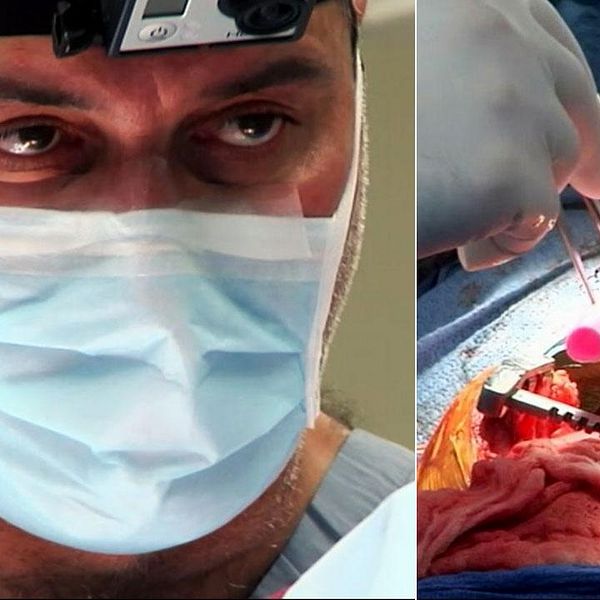 Världsberömde kirurgen Paolo Macchiarini har gjort tre experimentella transplantationer utan etiskt tillstånd.