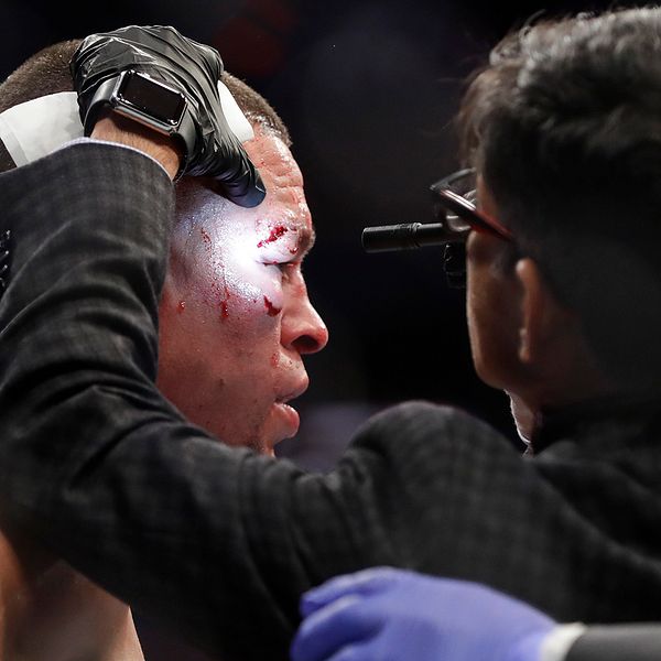 En läkare kollar närmare på UFC-stjärnan Nate Diaz under en match i november förra året.