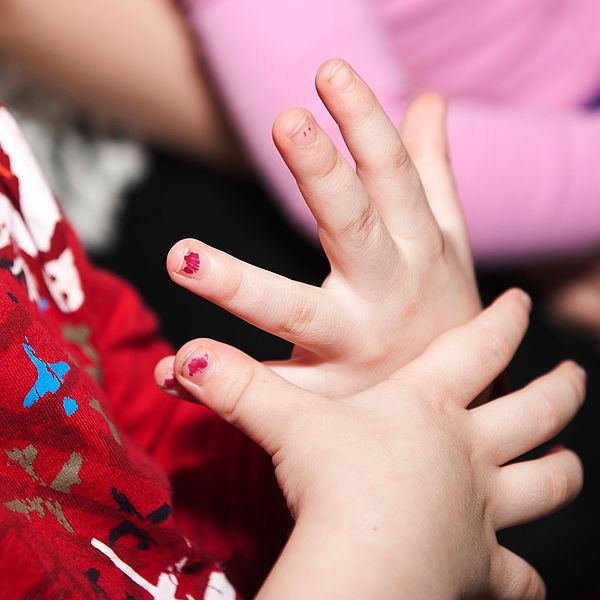 Barn i Norge får såriga och nariga händer när de tvättar händerna oftare än vanligt under coronapandemin. Nu har FHI ändrat sina rekommendationer för handtvätt. Bilden visar ett barns händer.