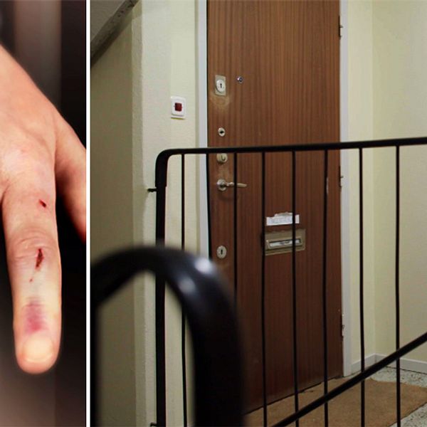 Hand med skador och blåmärken och en stängd dörr till lägenhet i trappuppgång.