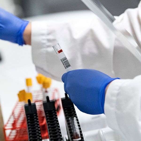 Blodprover görs klara för att analyseras avseende covid-19 antikroppar i ett laboratorium.