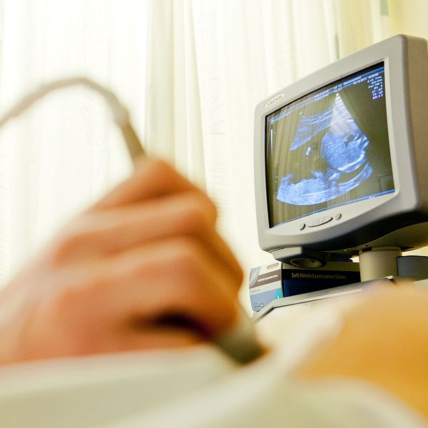 En hand som utför ultraljud på en gravidmage syns i förgrunden, i bakgrunden står en monitor i sjukhusmiljö.