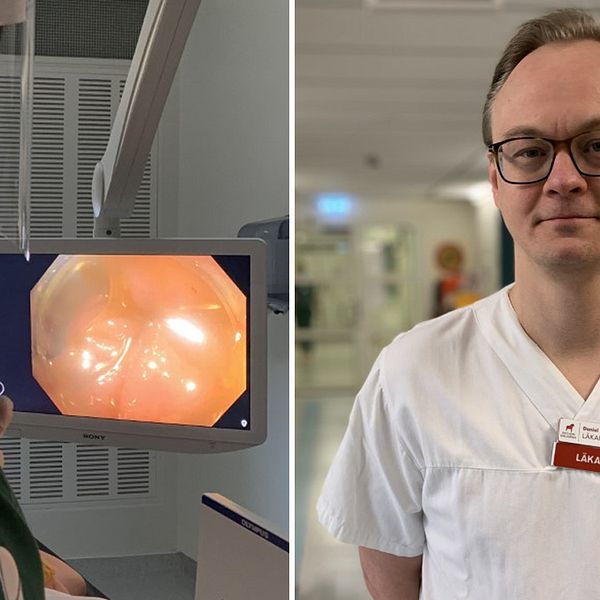 Bilden visar en patient som genomgår en så kallad koloskopi. Bilden visar också Daniel Sjöberg, specialistläkare inom mag-tarmsjukdomar som står i en korridor på Falu lasarett.