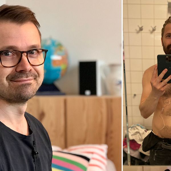 Tarmcancer, Mattias Johansson fotograferade sig själv under behandlingstiden