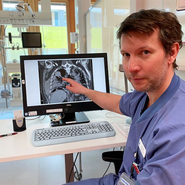 Läkaren Lars Falk pekar på en röntgenbild av ett par lungor. I bakgrunden syns sjukhusrummet.
