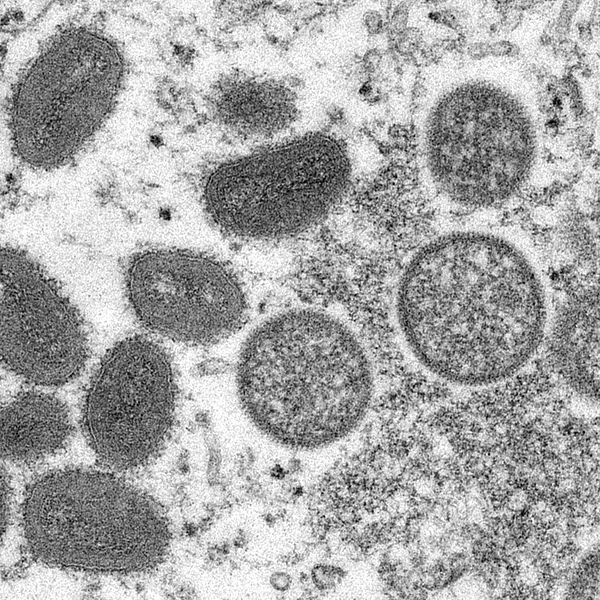En mikroskopbild från 2003 visar mogna, ovala apkoppsvirioner erhållna från ett prov av mänsklig hud i samband med präriehundsutbrottet samma år.