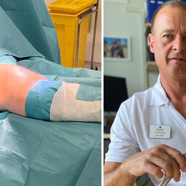 Till vänster ett knä på ett operationsbord samt en spruta, till höger läkaren Nils Hailer.