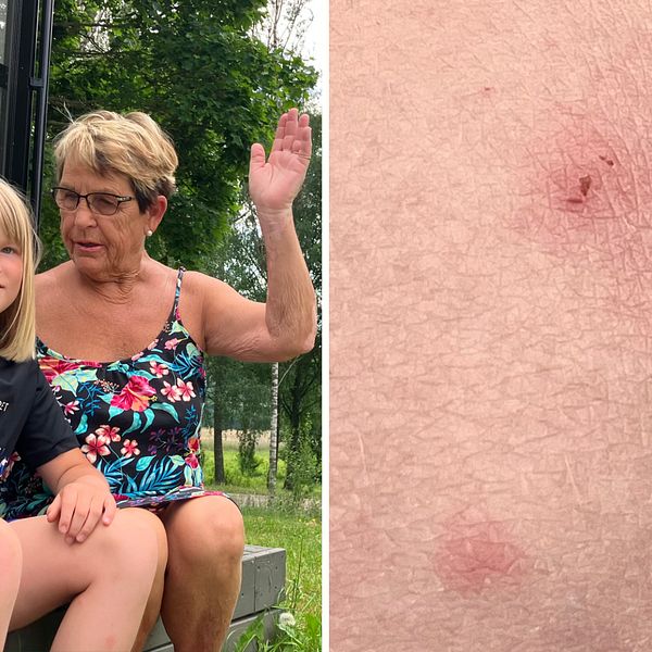Monica Persson och barnbarnet Linnea, 9 år, är hårt prövade av myggen i Deje.
