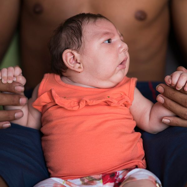 Dejailson Arruda håller sin dotter Luiza, som drabbats sedan mamman infekterats med Zika-viruset.