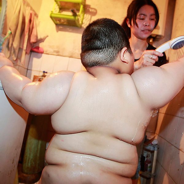 Den största delen av världens sjukligt feta barn bor i Asien.