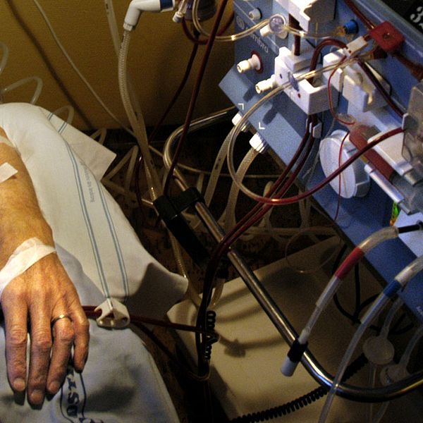 Svenskt njurregister har tidigare slagit fast att ett fungerande njurtransplantat erbjuder en nästintill normal blodrening, medan dialys, som genom en maskin som den på bilden, är avsevärt mindre effektivt och gör att kroppen åldras i förtid.