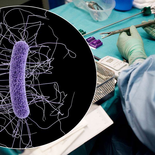 Arkivbild: En man drabbades av en allvarlig infektion av clostridiumbakterier i ett sår.
