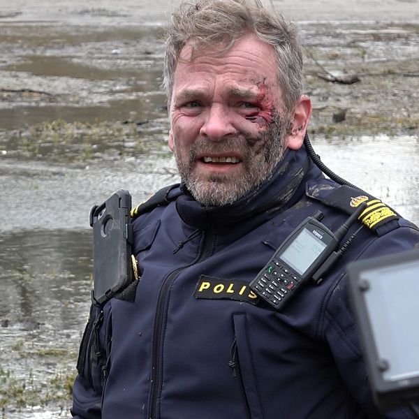 Filminspelning av tv-serien ”Tunna blå linjen 3”. Blodig skådespelare.