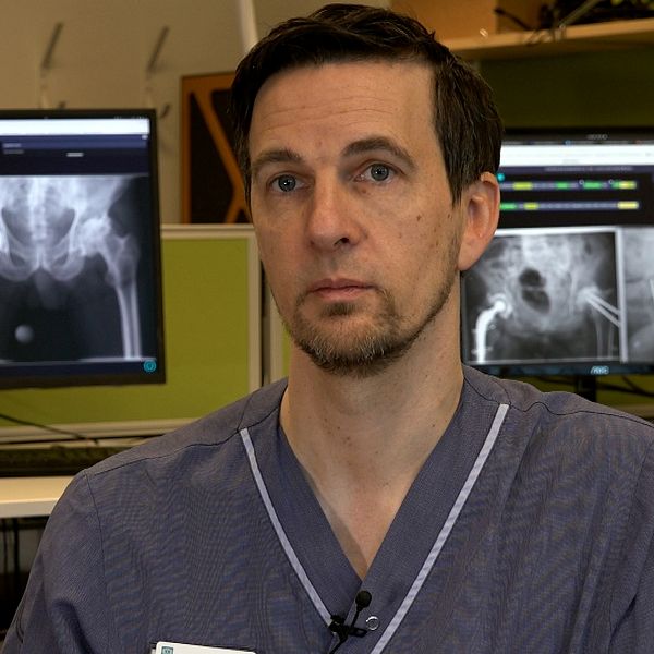 Max Gordon framför två datorskärmar med röntgenbilder