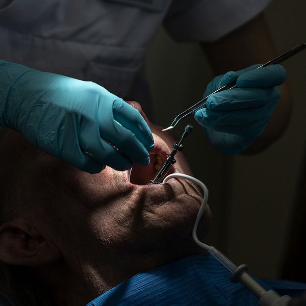 Genrebild på man som undersöks av tandläkare.