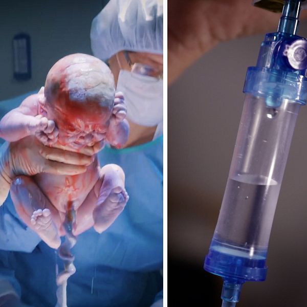 Tablett som sätter igång förlossning, bebis som förlöses med kejsarsnitt, dropp.