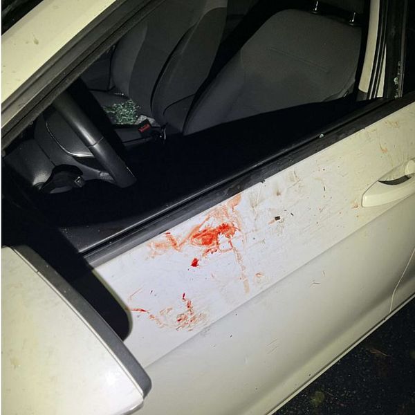Bildens vänstra sektion visar blodfläckar på en mörk väg belyst med blåljus, medan den högra sektionen visar blodfläckar på en vit bils dörr och inuti.