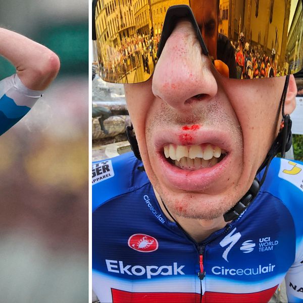 Jan Hirt krossade tre tänder i Tour de France-starten.