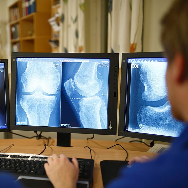 Tre datorskärmar visar röntgenbilder. Två personer som tittar på skärmarna syns snett bakifrån i förgrunden.