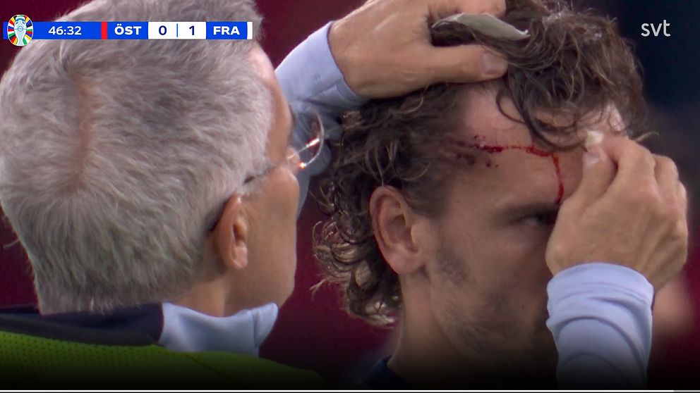 Griezmann slogs blodig