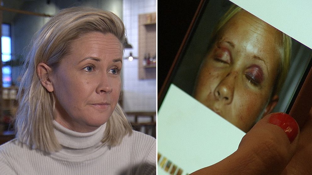 Lisa visar på sin telefon de skador hon fick i samband med tsunamin