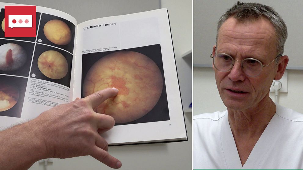 Splitbild med en hand som pekar i en medicinbok om urinblåsor och till höger en läkare.