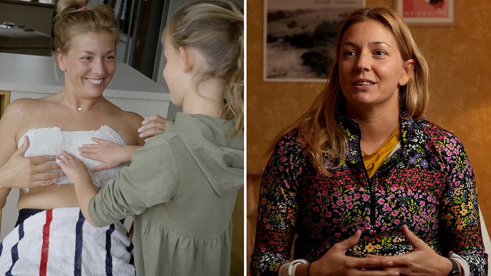 35-åriga Sofia Sköld bär på en BRCA-genförändring och opererar bort brösten för att minska cancerrisk.