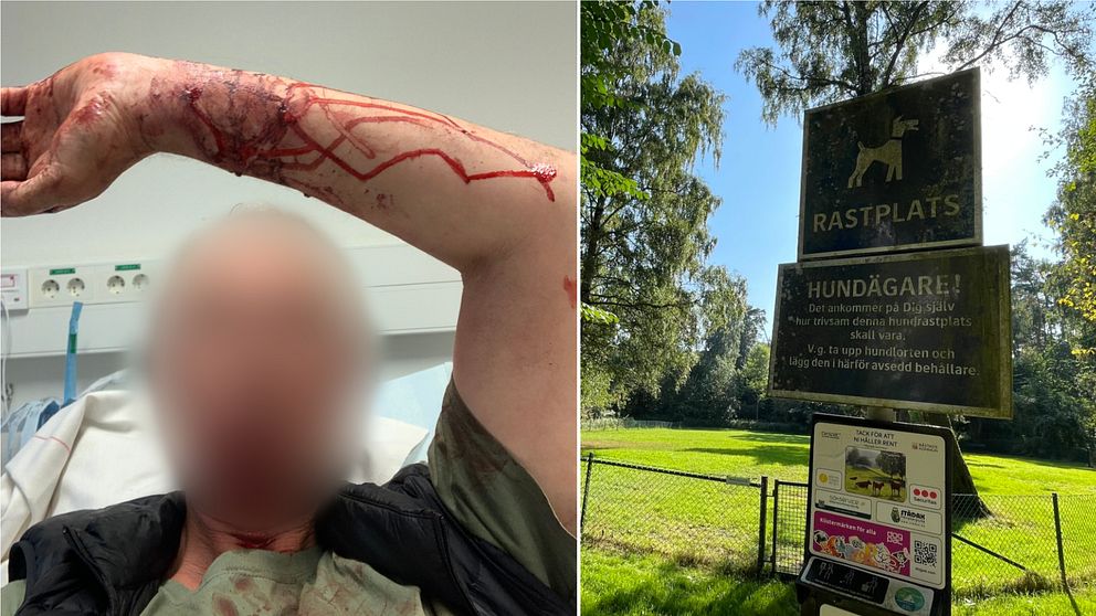 Mannen som attackerades har djupa hundbett på armarna, hans hund kanske inte klarar sig, händelsen har skapat stor oro på orten, hör mer i klippet.