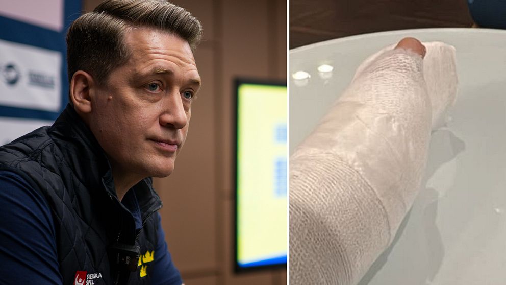 Sam Hallam om William Eklunds skada