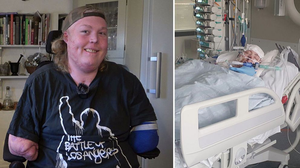 Viktor var 16 år när han fick sepsis och förlorade sina armar och ben.