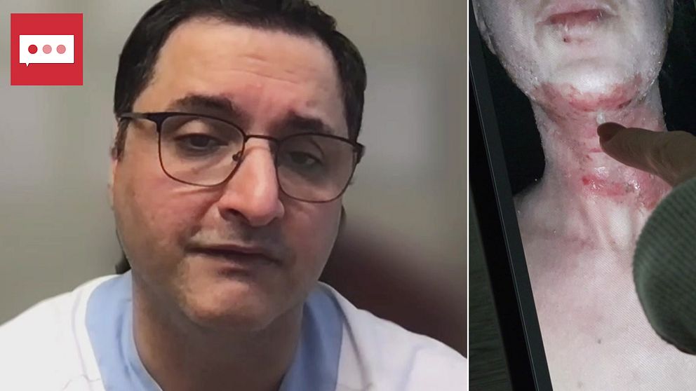 Delad bild. Alexander Shayesteh, hudläkare, till vänster. Bild på hudutslag till höger.