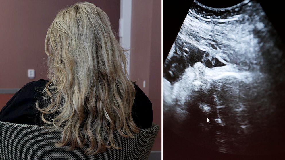 ”Sofia” med ryggen mot kameran och en ultraljudsbild sida vid sida.