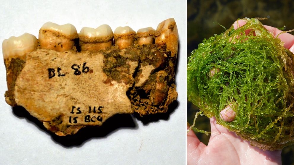 Människotänder från yngre stenåldern som innehåller rester av alger.