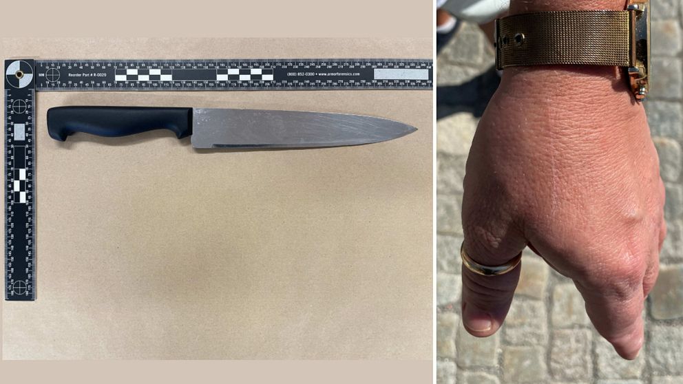 Kniv och en hand med en liten rispa.
