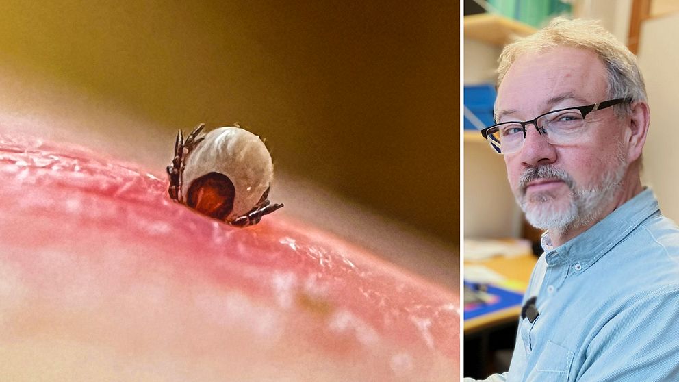Fästing som sitter i huden och en man på kontor