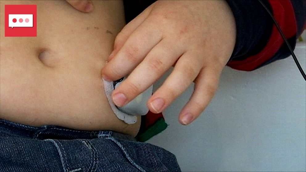 Ett barns hand justerar en insulinpump på magen.