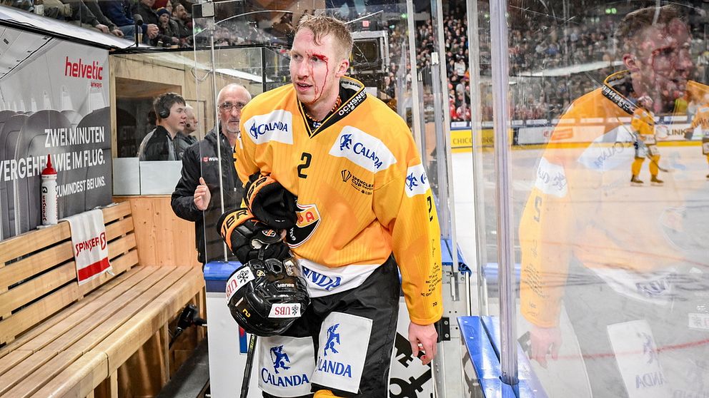 hockeyspelare med blod i ansiktet står i båset efter match