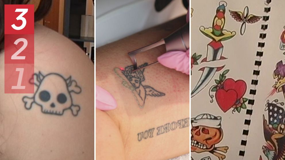 Tredelad bild. Vänster: dödskalletatuering. Mitten: tatuering på ängel lasras bort. Höger: tatueringsmotiv på papper.