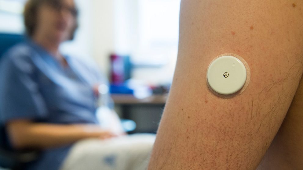 En arm med en medicinsk sensor fäst på huden, i bakgrunden en person i vårdmiljö.