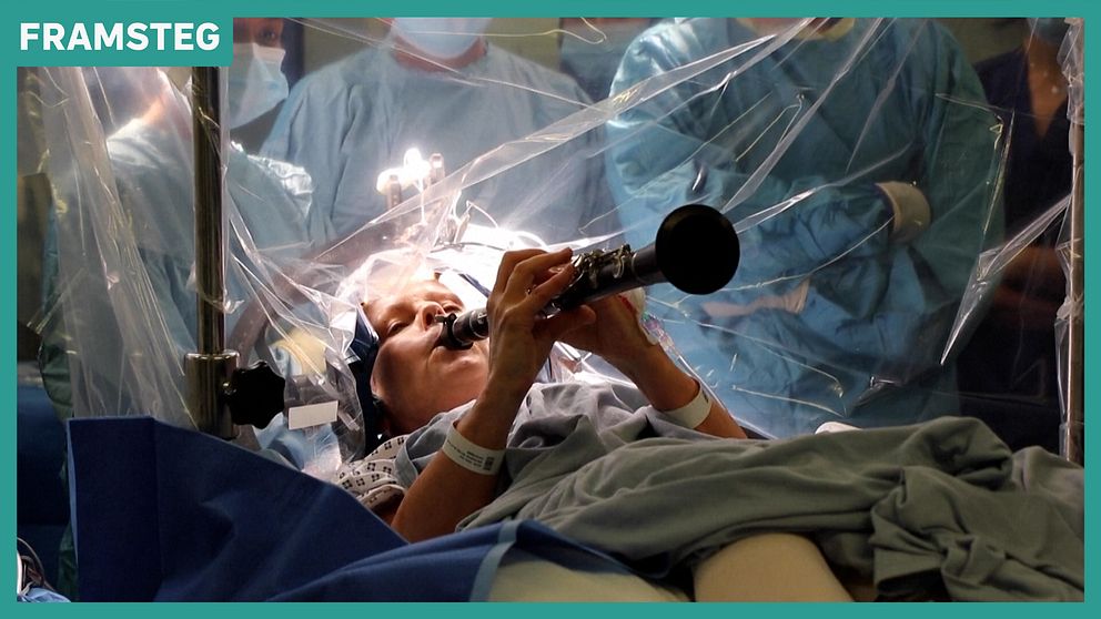 Denise Bacon spelar klarinett under en hjärnoperation omgiven av kirurger.