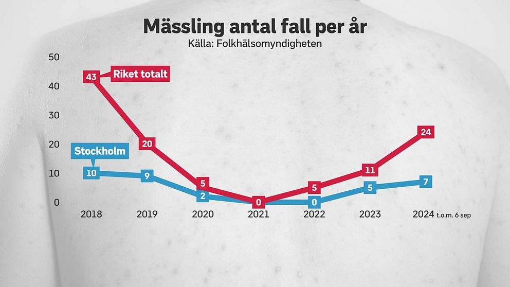 Antal mässlingsfall i Sverige sedan 2018