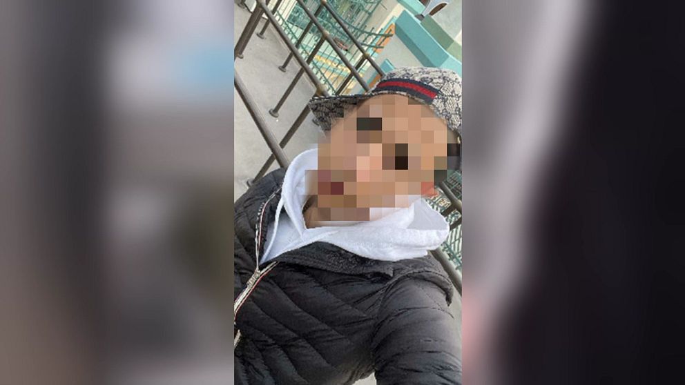 Person med pixlat ansikte framför oskarp bakgrund av byggnader.