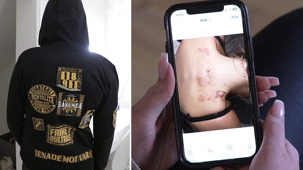 En delad bild som visar två sektioner. I den vänstra sektionen syns baksidan av en svart hoodie med olika emblem. I den högra sektionen håller en person en smartphone som visar en nära bild av ärr på en kvinnas rygg.