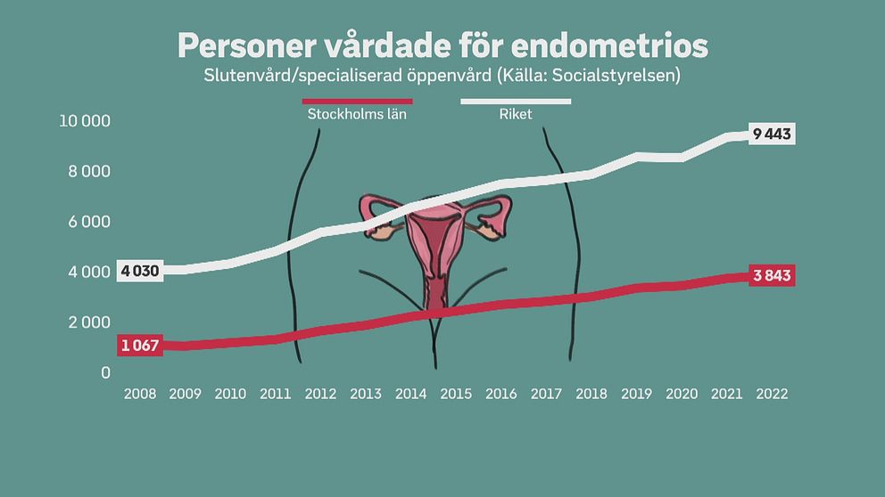 Graf över personer vårdade för endometrios 2008 till 2022
