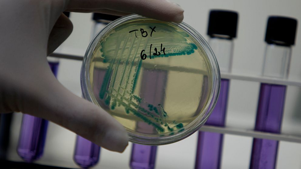En laboratoriemedarbetsställd håller en petriskål med grönt odlad mikroorganism i ena handen.