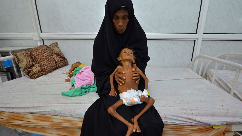 En mamma håller i sitt grovt undernärda barn i Jemen.