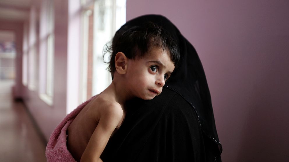 En mamma håller i sitt grovt undernärda barn i Jemen.